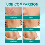 Scar Spray